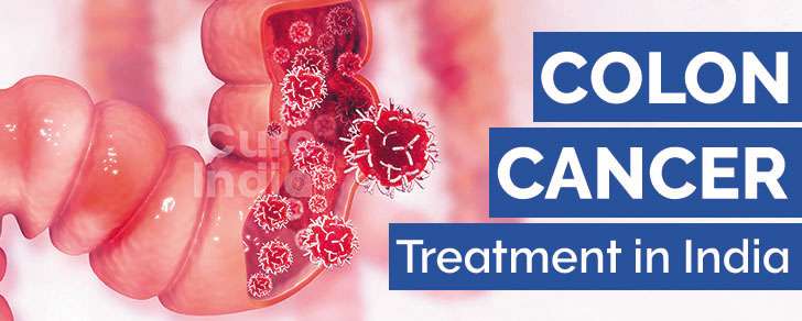 Colon Cancer Treatment in India